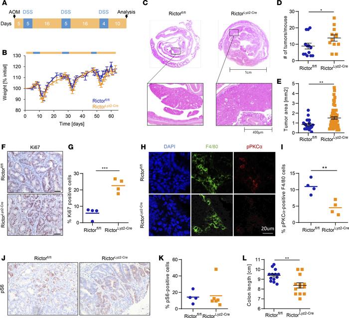 RictorLyz2-Cre mice have increased susceptibility for colorectal cancer....