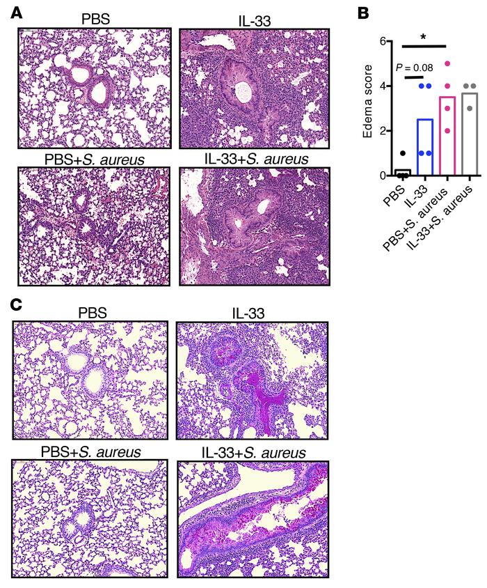 Intratracheal IL-33 pretreatment does not affect S. aureus–induced pulmo...