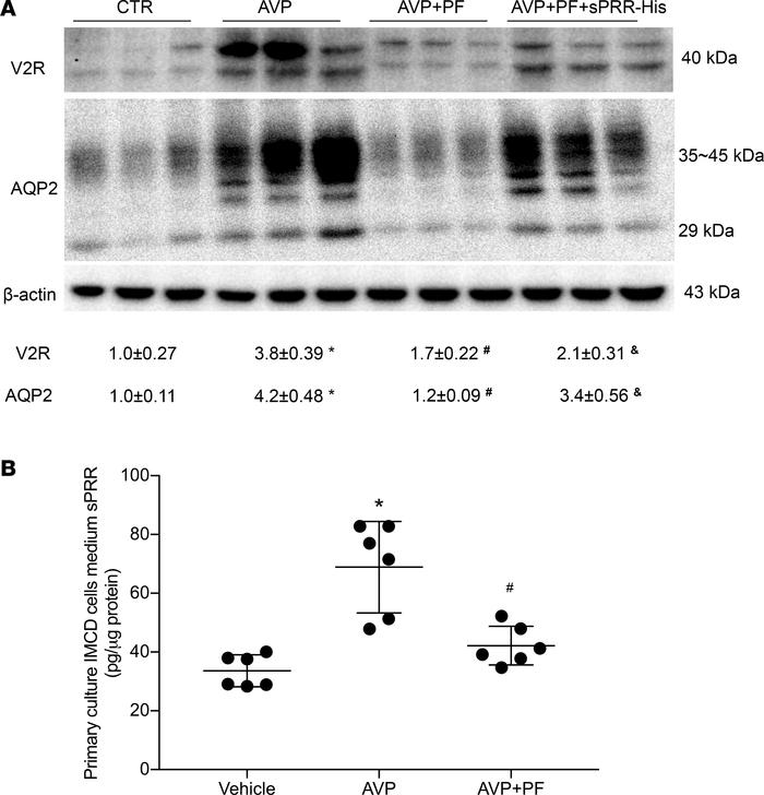 Effect of S1P inhibition alone or in combination with sPRR-His on AVP-in...