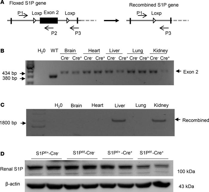 Validation of inducible renal tubule–specific deletion of S1P.
(A) Schem...