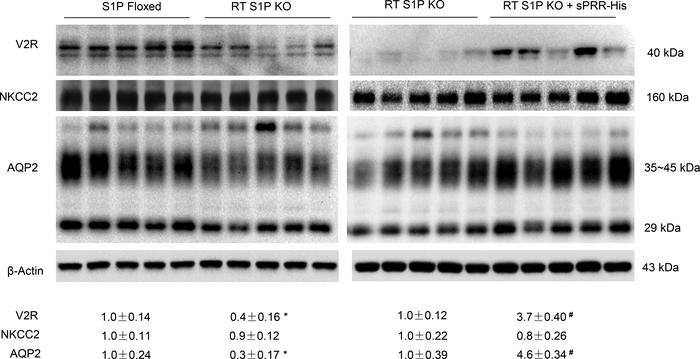 Analysis of renal expression of V2R and transporters in RT S1P–KO mice f...