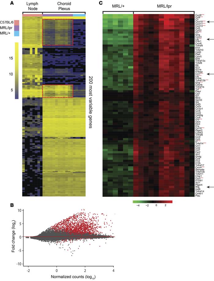 Enhanced expression of lymphoid tissue inducing molecules in lupus CP.
(...