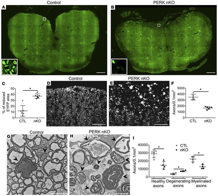 Neuron-specific PERK inactivation dramatically increased axon degenerati...
