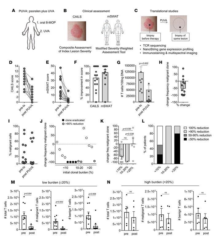 PUVA is an effective therapy for mycosis fungoides that can eradicate ma...