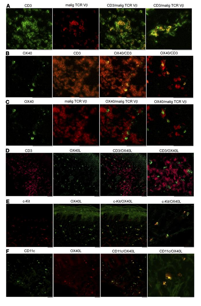 OX40 is expressed by benign T cells and OX40L is expressed by c-Kit+ den...