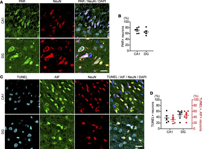 Hippocampal neurons from proband’s deceased sister show an increase in n...