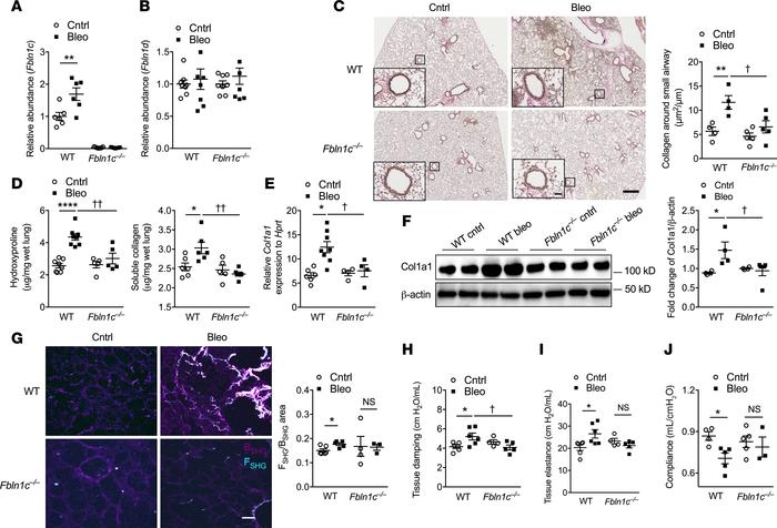 Bleomycin challenge of Fbln1c–/– mice does not induce airway or lung fib...