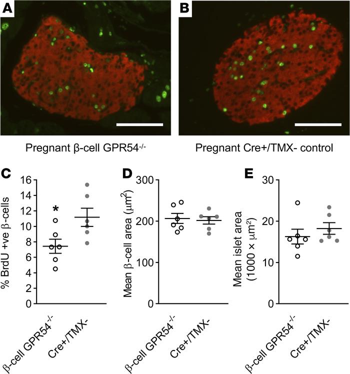 Effects of deletion of β cell GPR54 on pregnant β cell mass.
Representat...