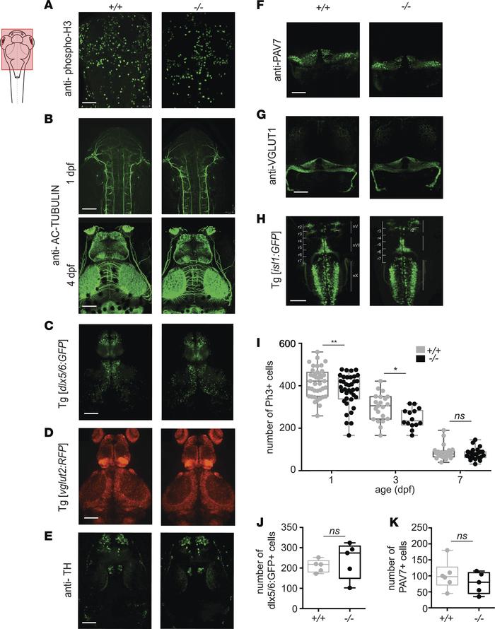 The main brain networks are not affected by gldc KO despite a transient ...