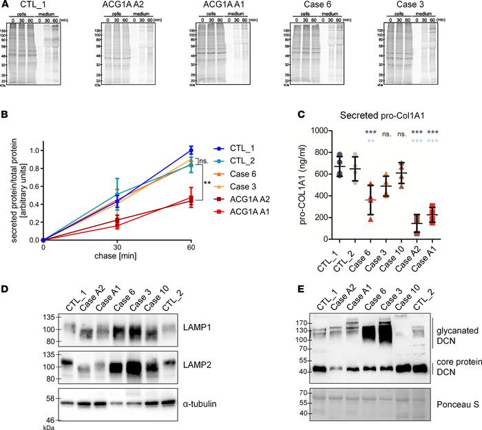 Normal global secretory traffic but defective glycan processing by the G...
