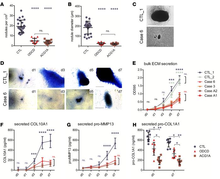 Impaired synthesis of extracellular matrix (ECM) components and disrupte...