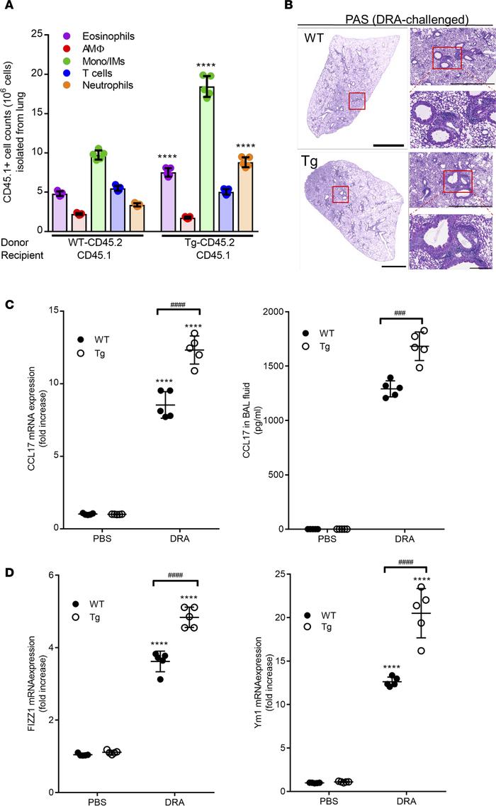 Adoptive transfer of Sirt2-overexpressing transgenic lung macrophages ex...