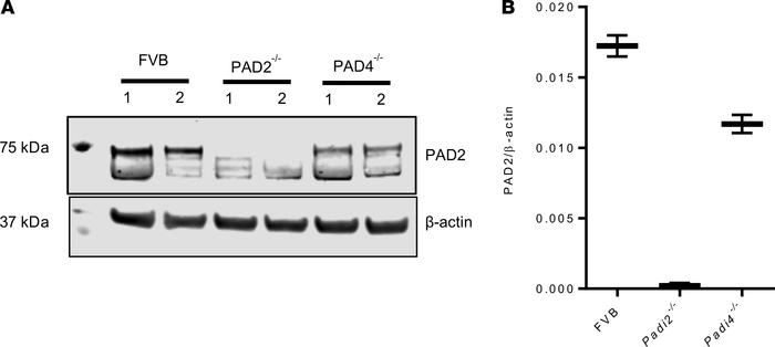 PAD2 expression in murine CD4+ T cells.
(A and B) Splenocytes isolated f...