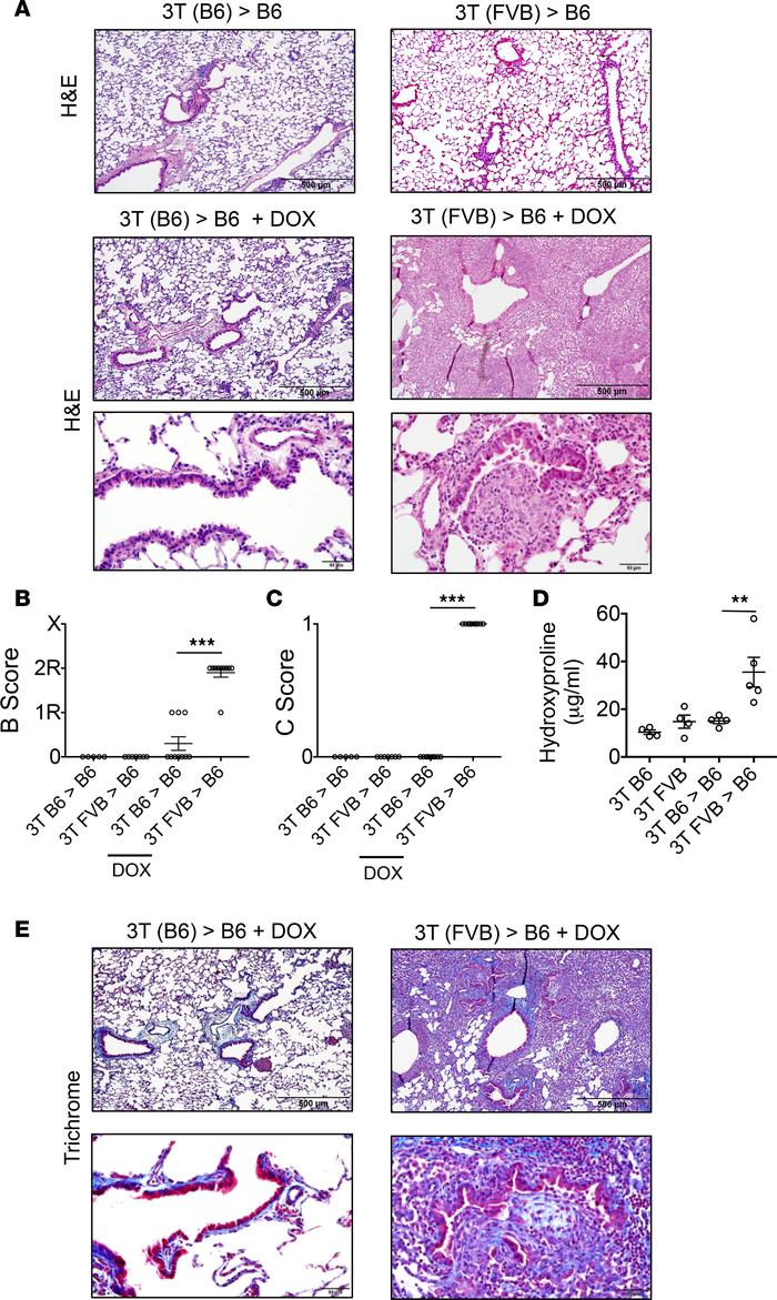 Club cell ablation leads to severe OB lesions in lung allografts.
(A) H&...