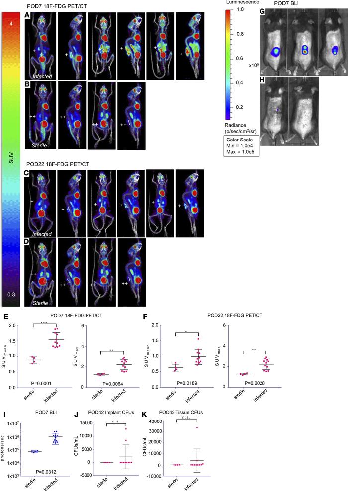 
18F-FDG PET imaging.
18F-FDG PET/CT imaging was performed on POD 7 (acu...