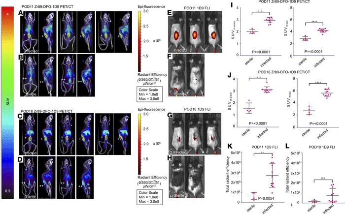 
89Zr-680-1D9 PET Imaging.
89Zr-680-1D9 PET/CT imaging was performed on ...