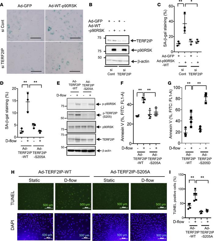 TERF2IP S205 phosphorylation plays a crucial role in EC senescence.
(A–C...