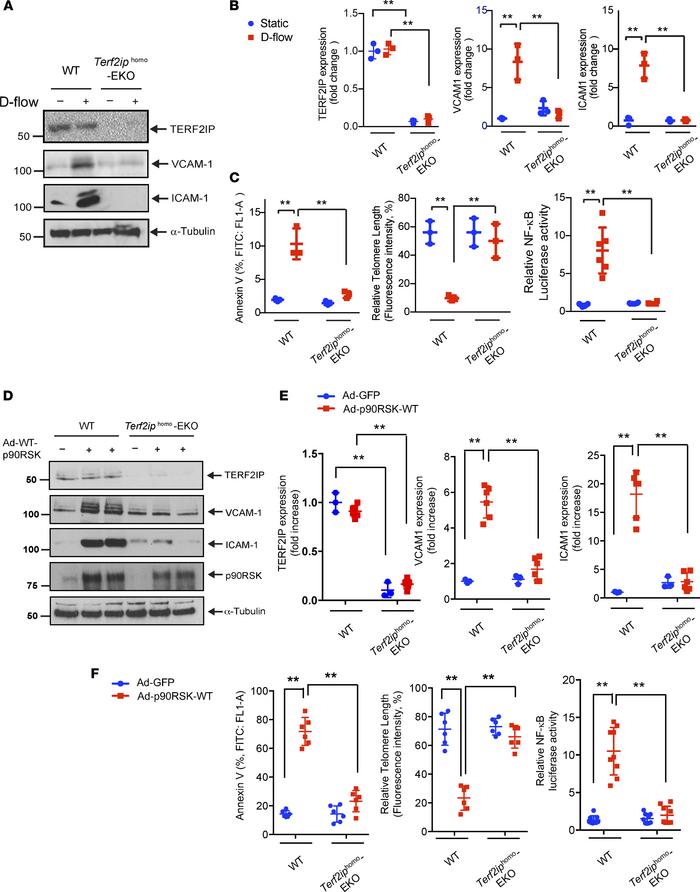 Depletion of TERF2IP inhibits EC senescence and activation in vitro.
(A–...