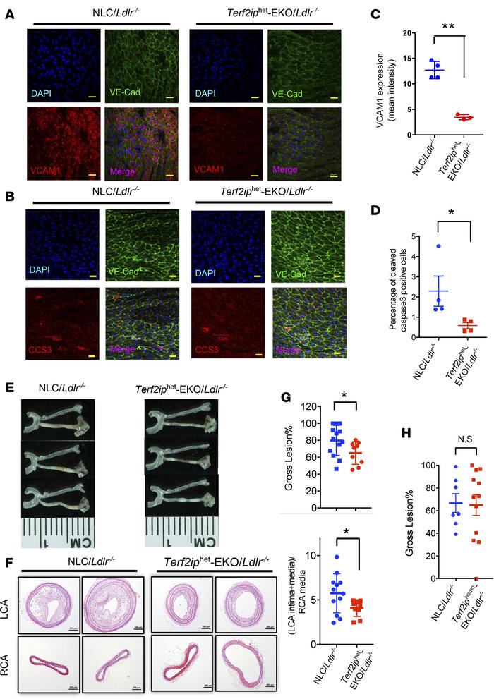 Endothelial activation and apoptosis, as well as subsequent atherosclero...