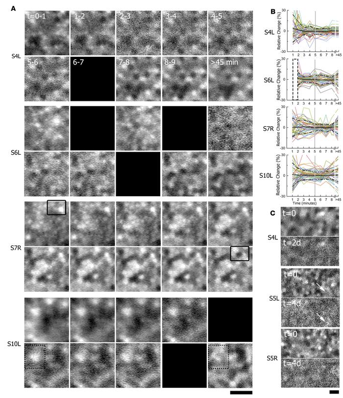 Dynamic establishment of heterogeneous pattern.
The same retinal regions...