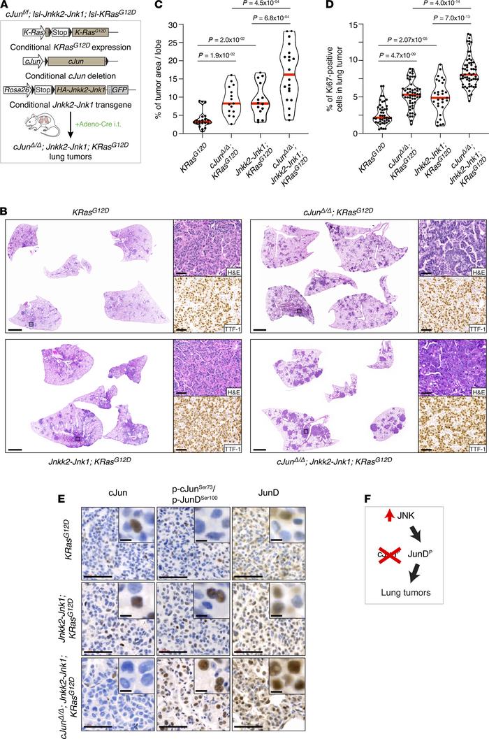 JNK activity is protumorigenic in the absence of c-Jun.
(A) Schematic re...