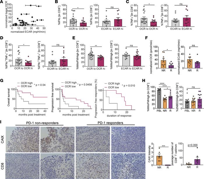 Oxidative metabolism of tumor cells and hypoxia are associated with decr...