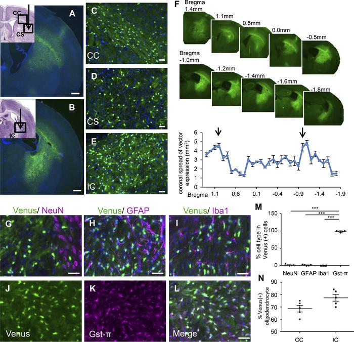 Widespread oligodendrocyte-specific transgene expression in cerebral whi...