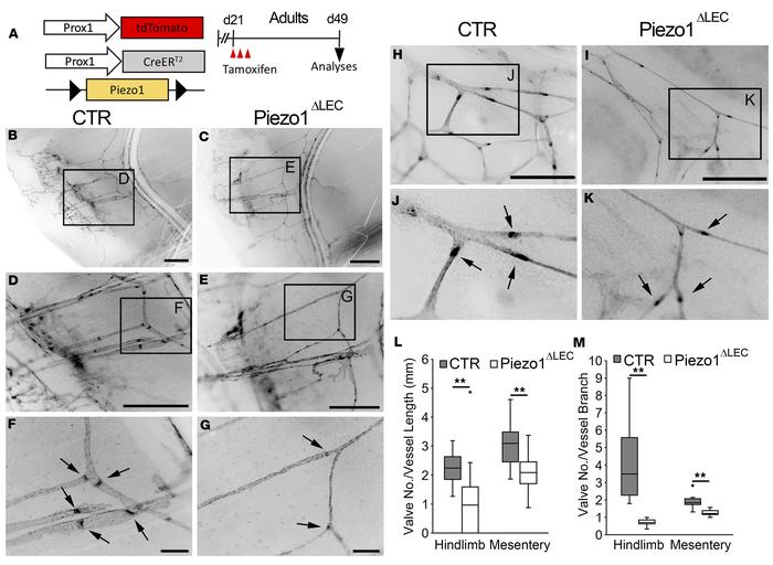 Piezo1 is required for lymphatic valve maintenance.
(A) Experimental des...