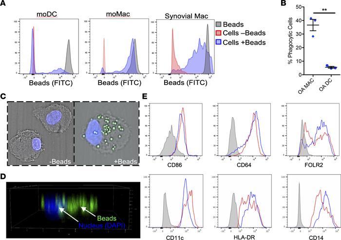 Synovial tissue macrophages.
Synovial tissue from OA total knee replacem...