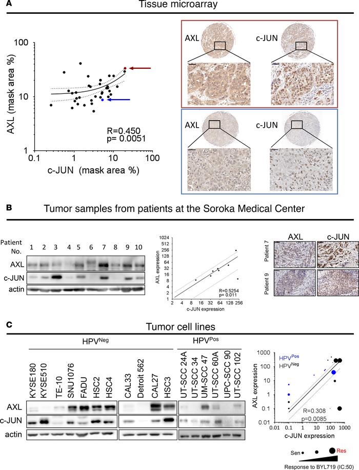 AXL and c-JUN levels are correlated in clinical samples of HNSCC tumors ...
