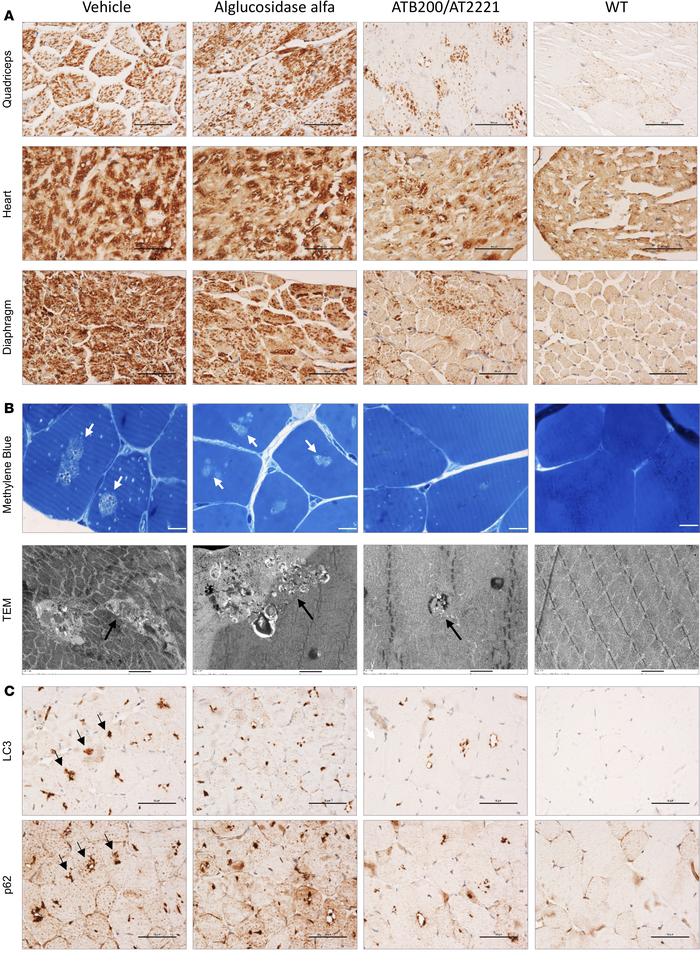 ATB200/AT2221 corrects lysosomal and autophagic pathologies in Gaa-KO mi...