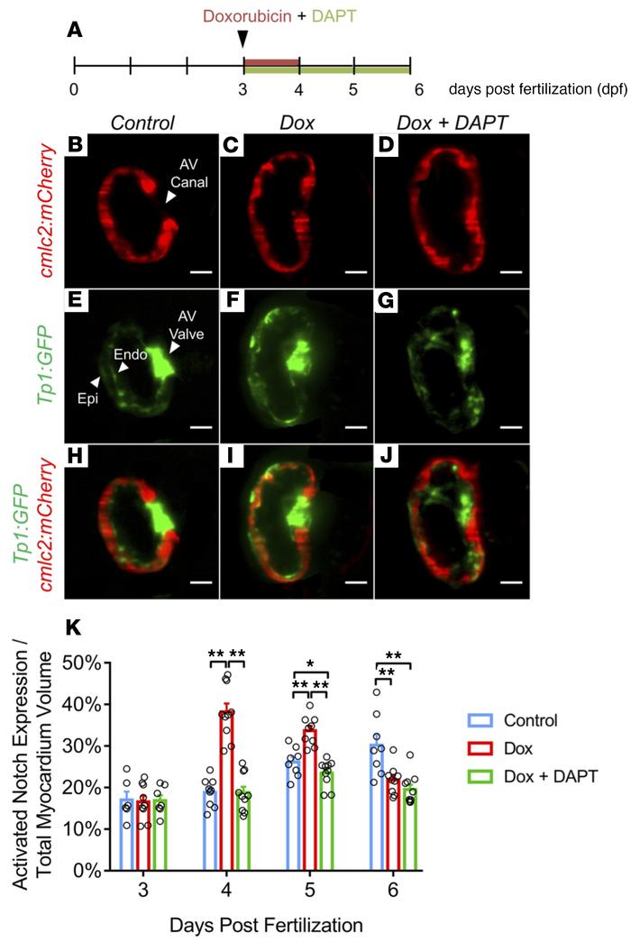 Chemo-induced injury induces cardiac Notch activation.
(A) Experimental ...