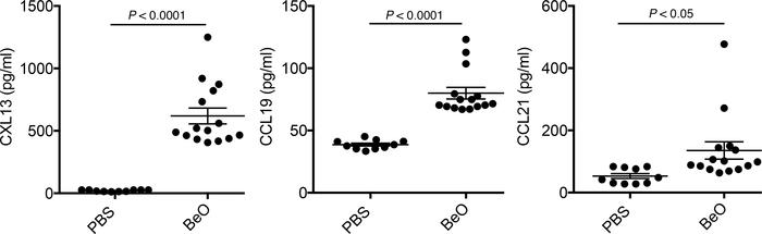 BeO exposure induced secretion of homeostatic B cell chemokines.
HLA-DP2...
