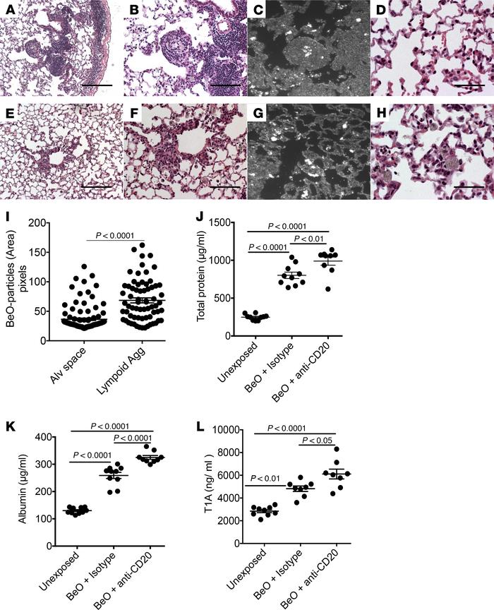BeO exposure enhanced acute lung injury in HLA-DP2–Tg mice deficient in ...