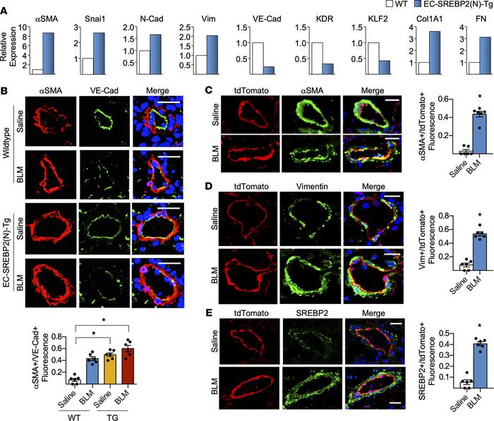 BLM-induced SREBP2 promotes EC phenotypic switch and partial EndoMT in m...