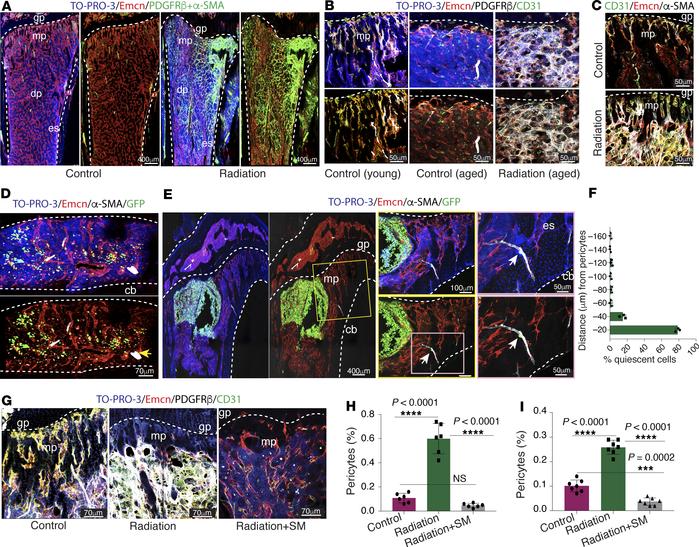 Radiation and chemotherapy drive bone-specific expansion of the pericyte...