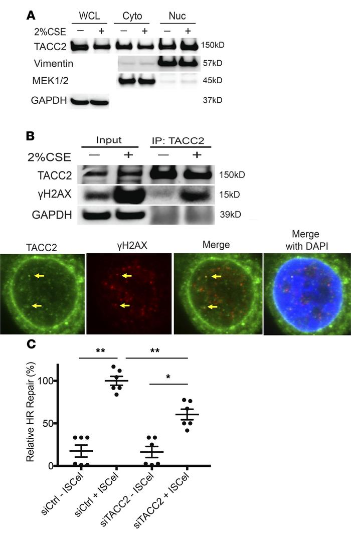 TACC2 is partially translocated into the nucleus and associated with γH2...