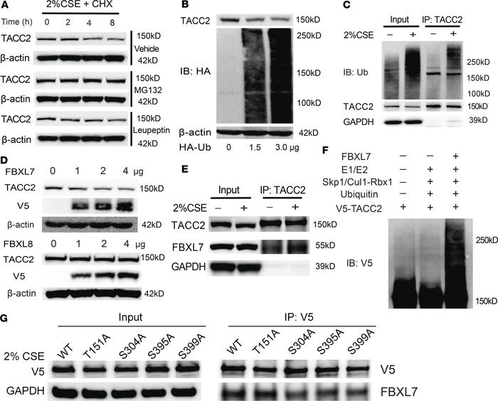 An SCF E3 Ligase F-box component targets TACC2 for polyubiquitination.
(...