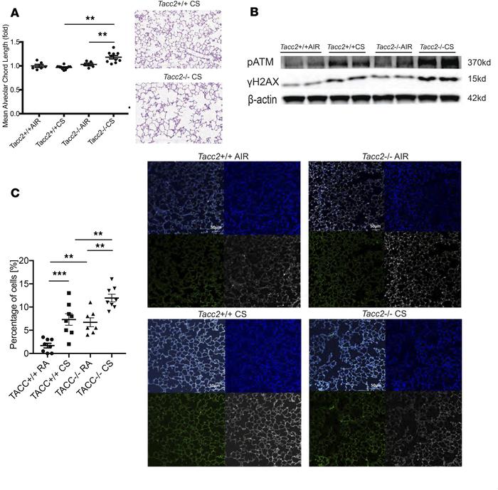 The genetic deletion of TACC2 augments cigarette smoke–induced DNA damag...