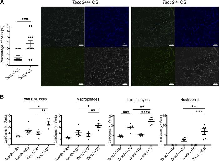 Cigarette smoke exposure enhances epithelial cell death and lung inflamm...