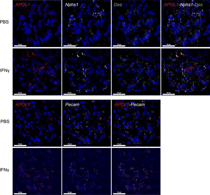 IFN-γ induces kidney APOL1 expression in podocytes and endothelial cells...