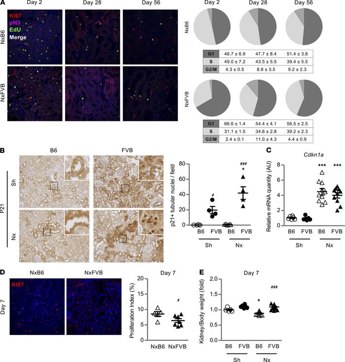 Nephron reduction results in G1 cell cycle arrest during compensatory gr...