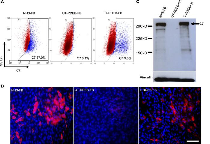 Molecular characteristics of GMP-manufactured gene-modified autologous f...