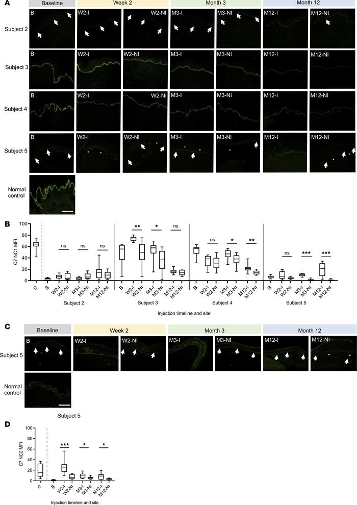 Type VII collagen (C7) expression in subjects 2–5 at baseline and in inj...