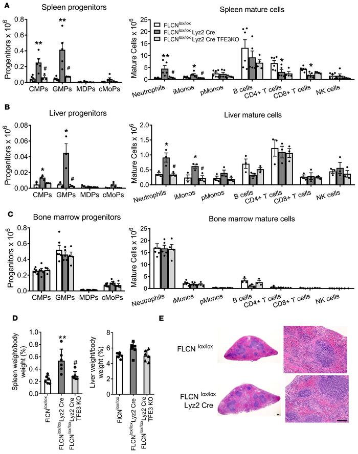 Loss of FLCN in monocyte lineage leads to expansion of peripheral monocy...