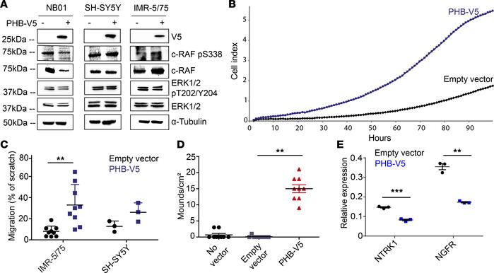 Ectopic expression of PHB promotes proliferation, migration, and dediffe...