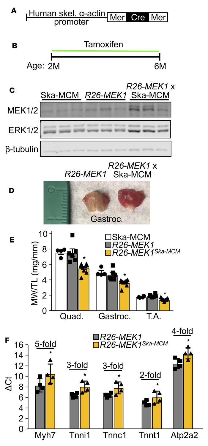 Induction of activated MEK1 expression in mature myofibers induces a slo...