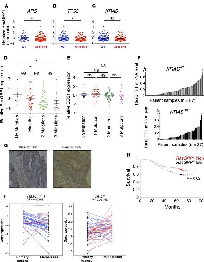 RasGRP1 is a prognostic marker for CRC.
(A–C) RasGRP1 expression in huma...