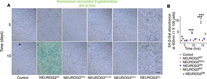 NEUROG3WT-induced senescence is repressed by NEUROG3DN in BON4 cells.
(A...