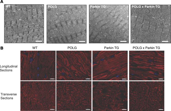 Identification of megamitochondria in aged POLG hearts.
(A) Representati...